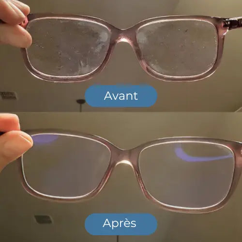 ELYS PureVision™ – Boîte de désinfection pour lunettes ELYS Shop