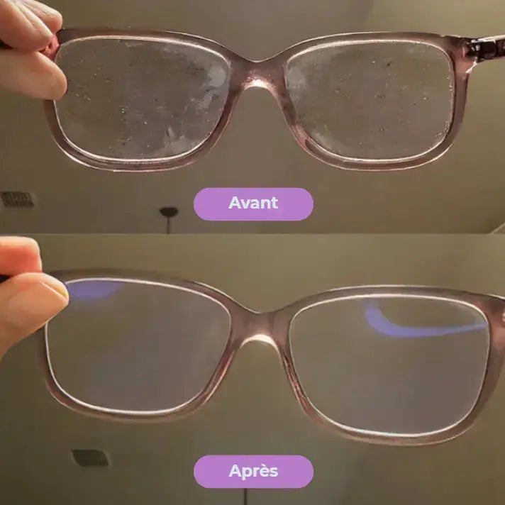 ELYS PureVision™ – Boîte de désinfection pour lunettes ELYS Shop